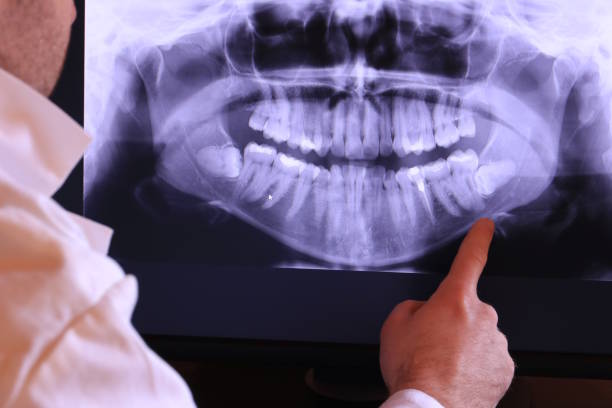 Best Emergency Dental Surgery in Tiger Point, FL